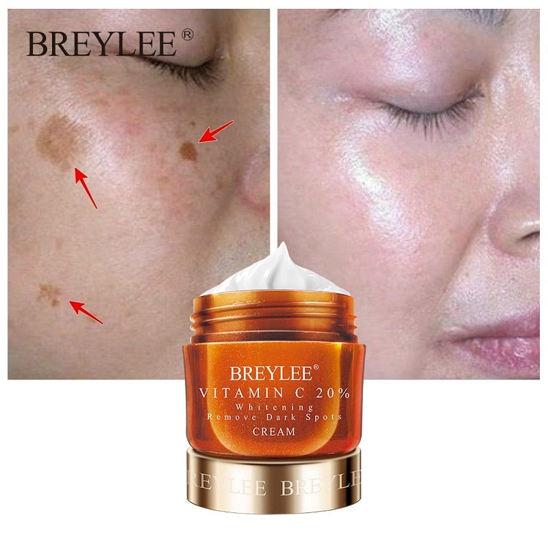 BREYLEE Vitamin C 20% VC Whitening Facial Cream Repair Fade Freckles Remove Dark Spots Melanin Remover Brightening Face Cream