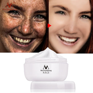 Powerful Whitening Freckle Cream 40g Remove Melasma Acne Spots Pigment Melanin Dark Spots Face Lift Firming Face Care Cream skin