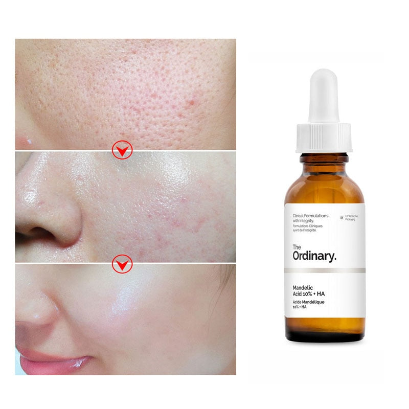 The Ordinary 10% Mandelic Acid+Hyaluronic Acid Exfoliating Serum Shrink Pores Fade Acne Mark Improve Closed Mouth Face Skin Care